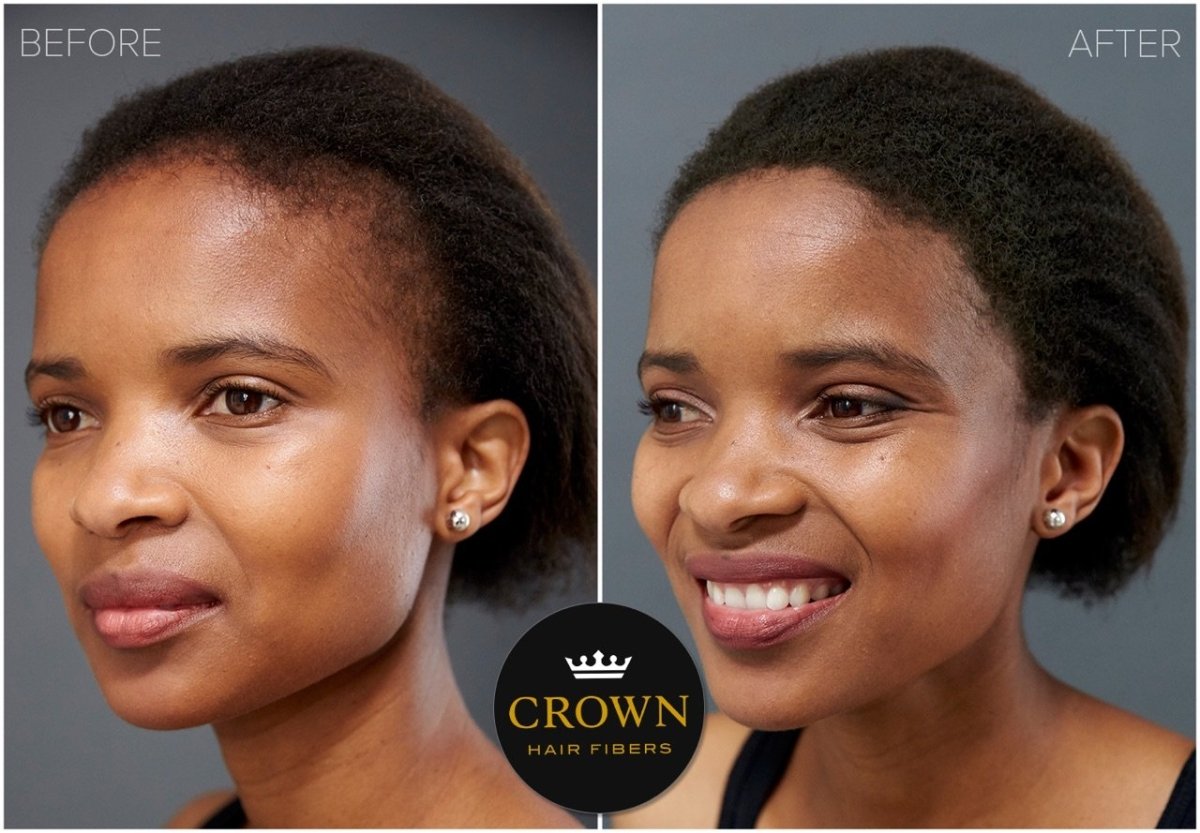 Crown Hair Fibers Hair Loss Concealer (28g) - 75 Day Supply - HairoCROWN TWENTY 1CRO2501