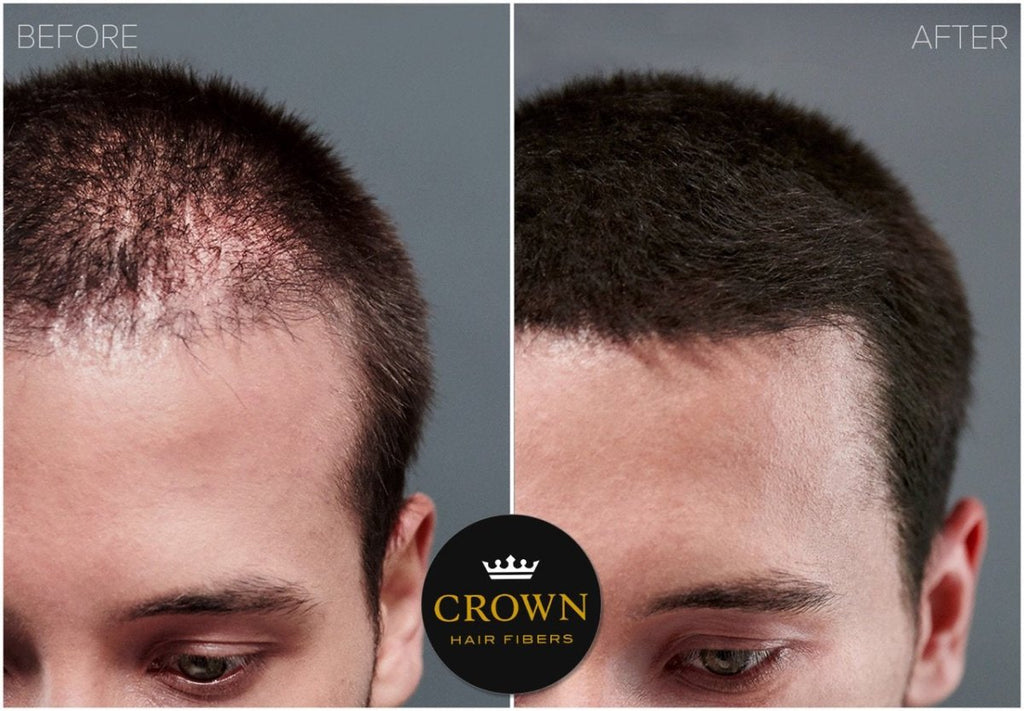 Crown Hair Fibers Hair Loss Concealer (28g) - 75 Day Supply - HairoCROWN TWENTY 1CRO2501