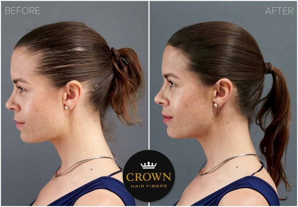 Crown Hair Fibers Hair Loss Concealer (28g) - 75 Day Supply - HairoCROWN TWENTY 1CRO2501