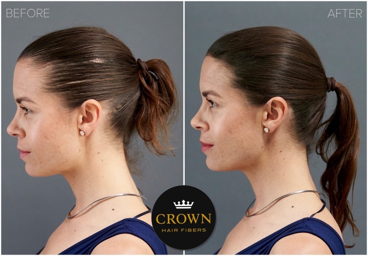 Crown Hair Fibers Hair Loss Concealer (28g) - 75 Day Supply - HairoCROWN TWENTY 1CRO2501