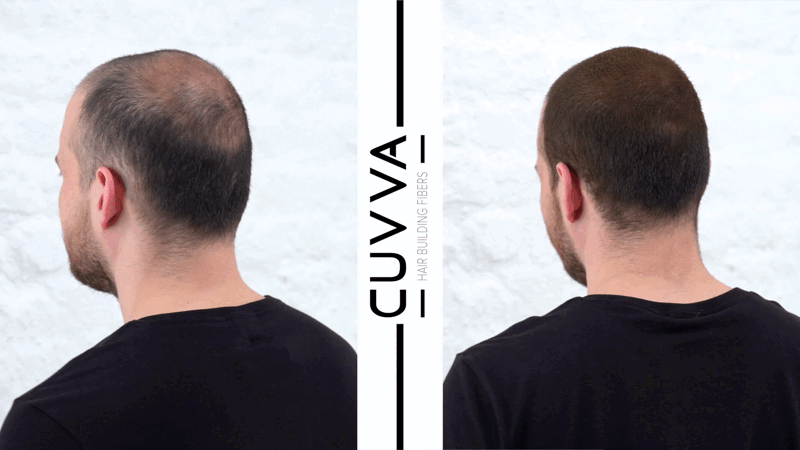 Cuvva Hair Fibers for Hair Loss & Balding Hair - 2 x 25g