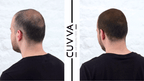 Cuvva Hair Fibers for Hair Loss & Balding Hair - 2 x 25g